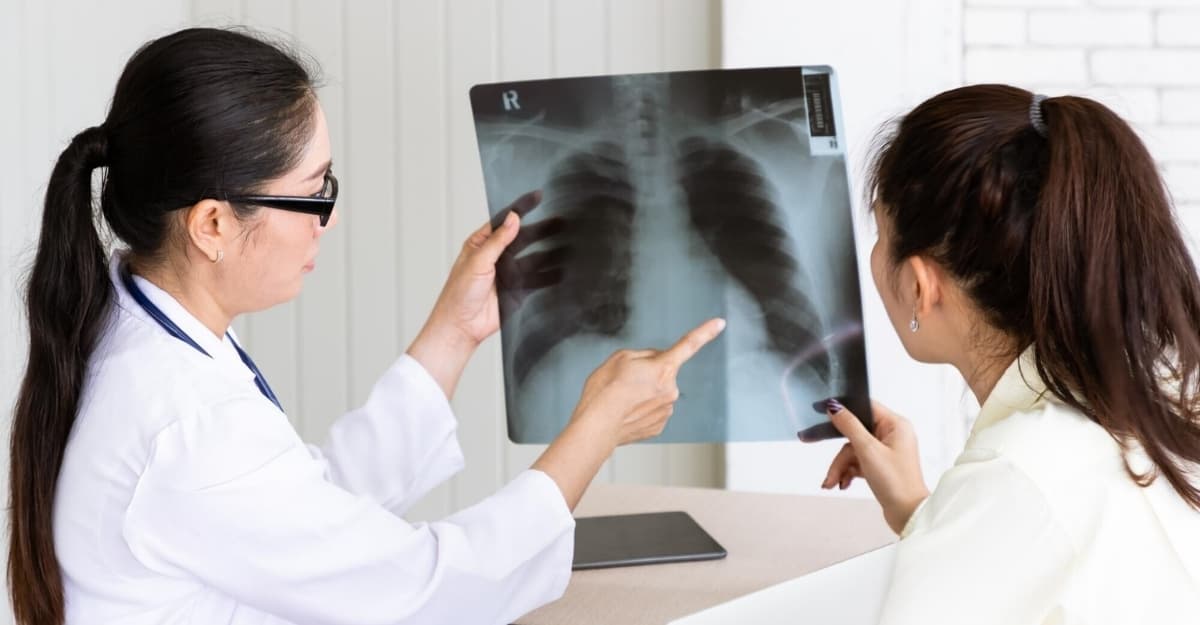 Ung thư phổi có di truyền không? Tỷ lệ và dấu hiệu nhận biết