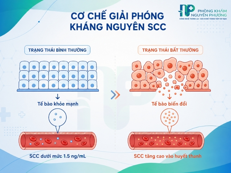 Kháng nguyên SCC được sinh ra từ tế bào biểu mô vảy và tăng cao khi cổ tử cung tổn thương