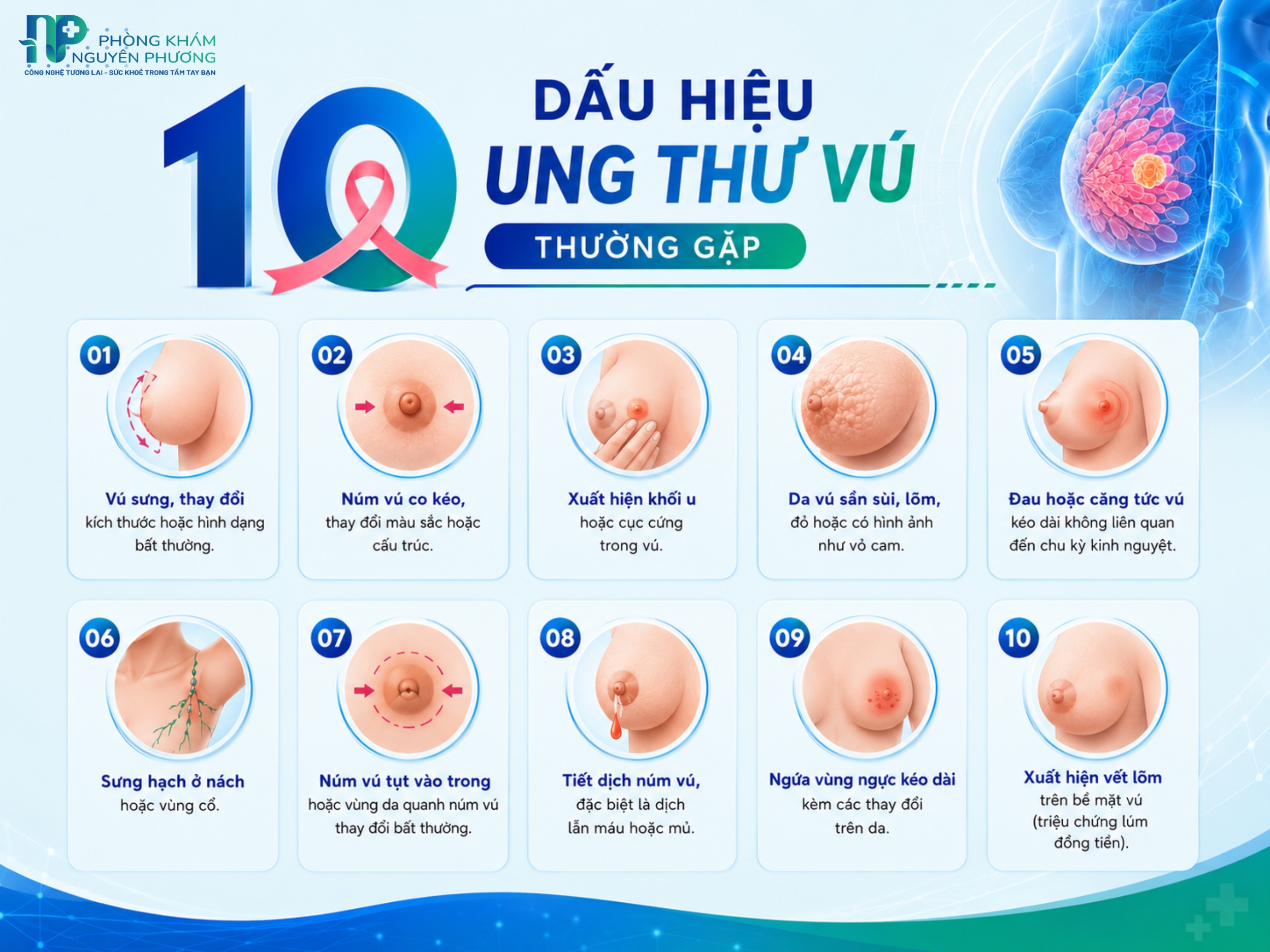 Các dấu hiệu cảnh báo ung thư vú cần biết