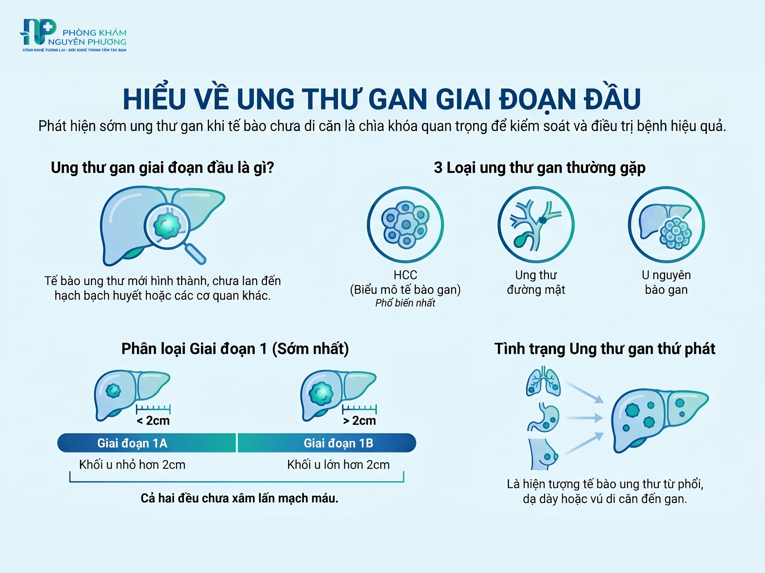 Tìm hiểu về ung thư gan giai đoạn đầu