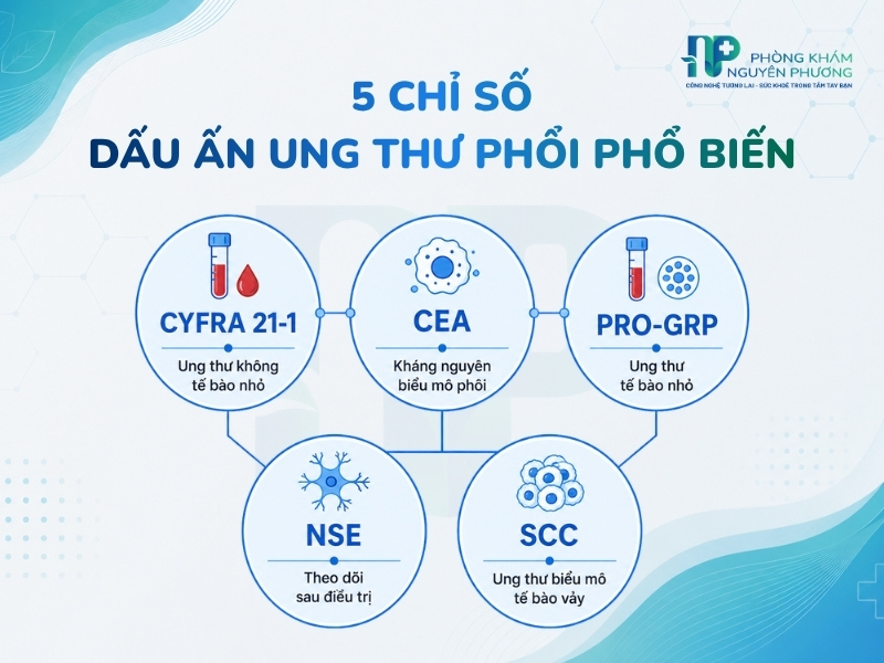 Các chỉ số kháng nguyên hỗ trợ bác sĩ theo dõi và đánh giá nguy cơ u phổi