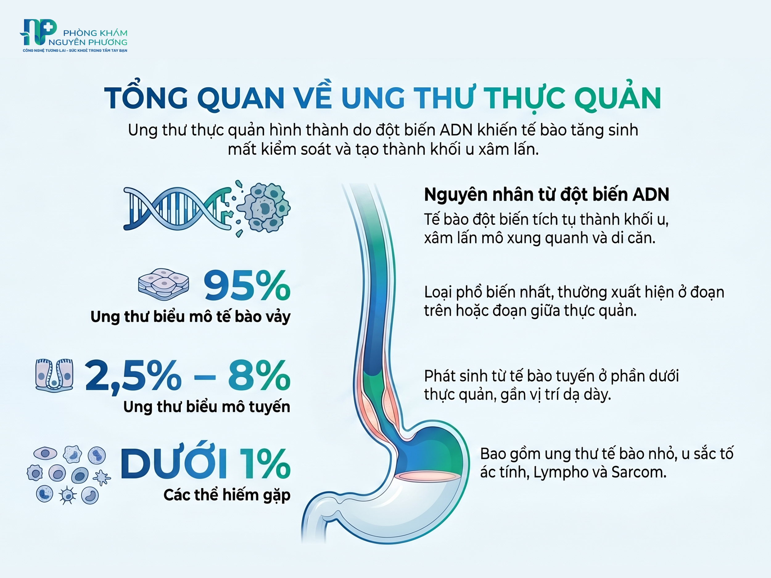 Tổng quan về ung thư thực quản