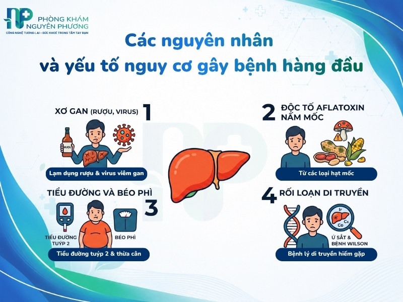 Xơ gan và các bệnh lý nền là yếu tố hàng đầu làm tăng nguy cơ mắc bệnh.