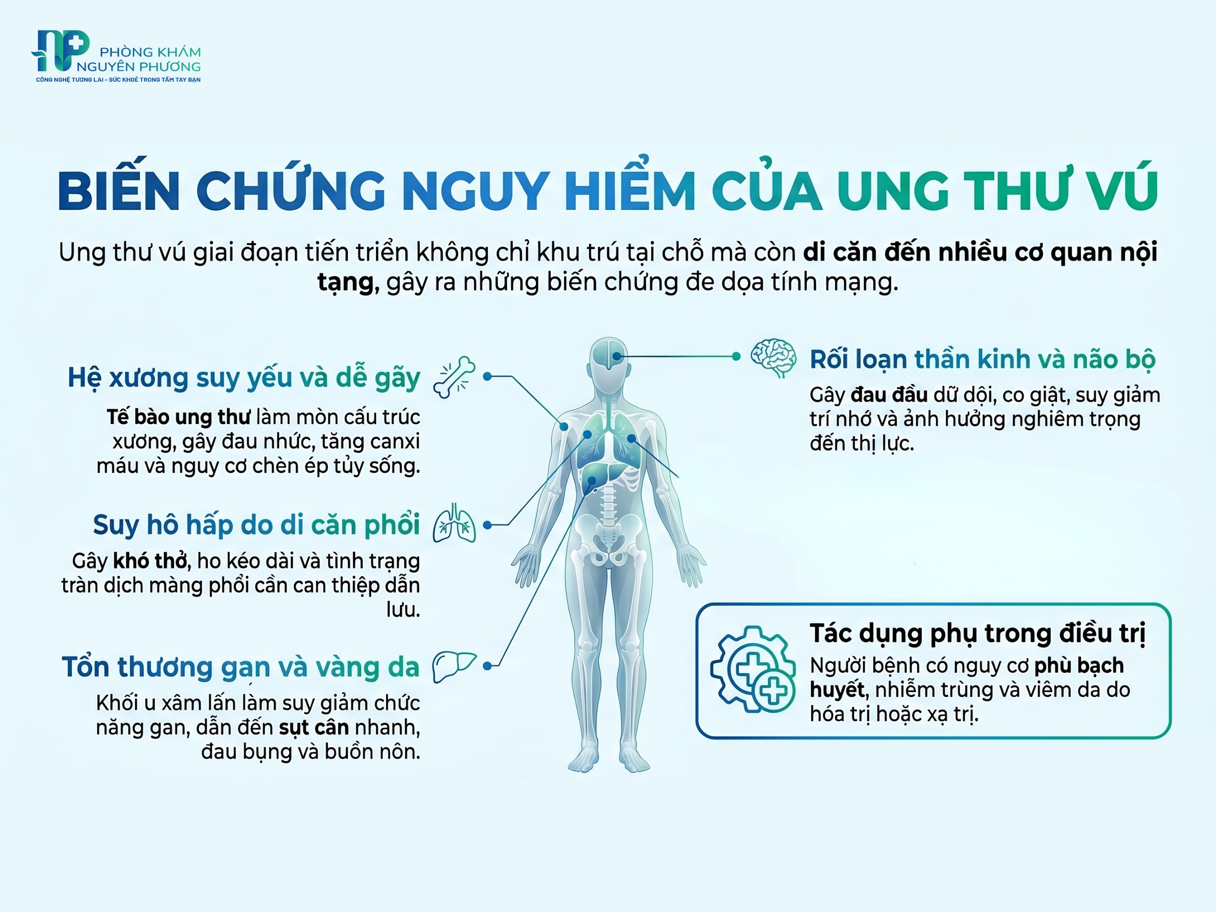 Những biến chứng có thể xảy ra khi bị ung thư vú