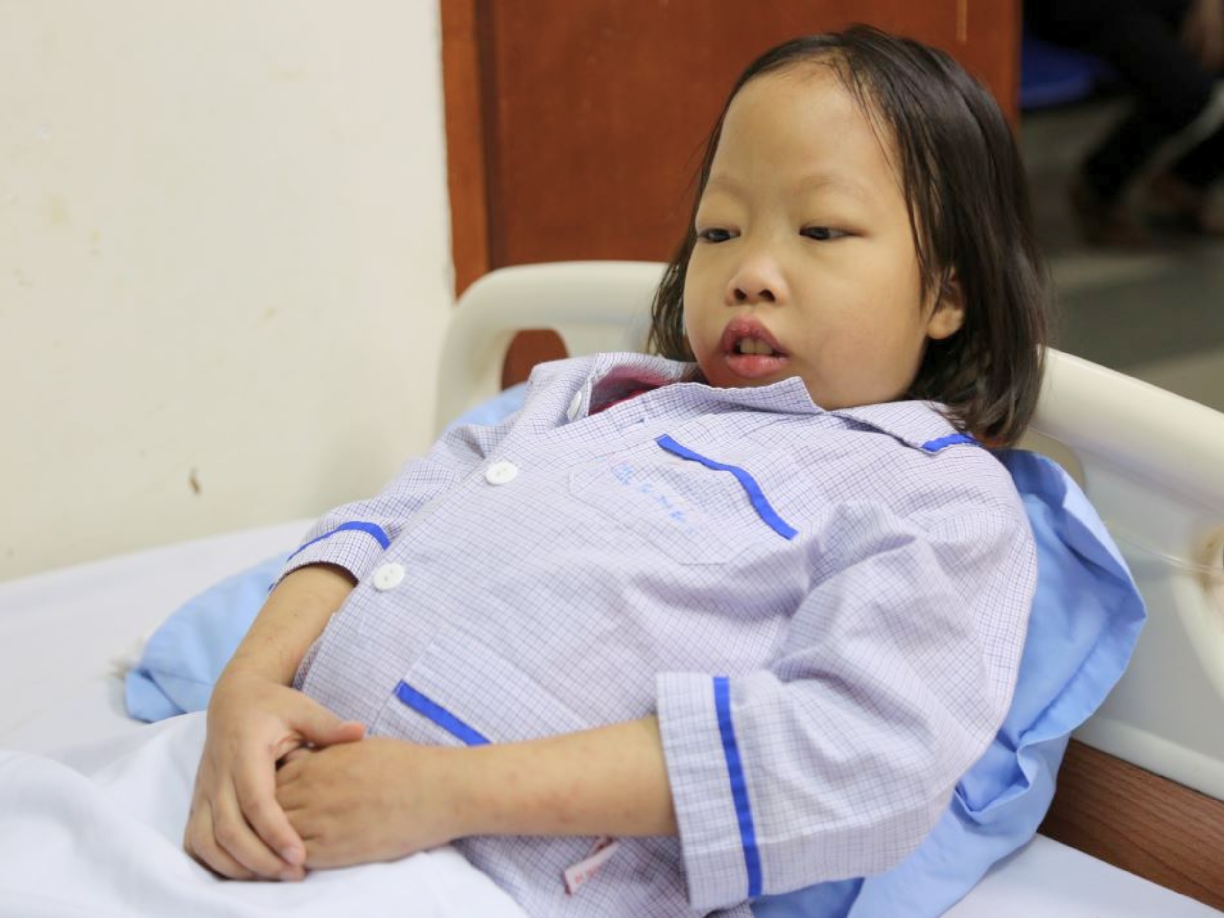 Tan máu bẩm sinh có thể gây ảnh hưởng toàn diện đến sức khỏe với nhiều biểu hiện từ nhẹ đến nặng