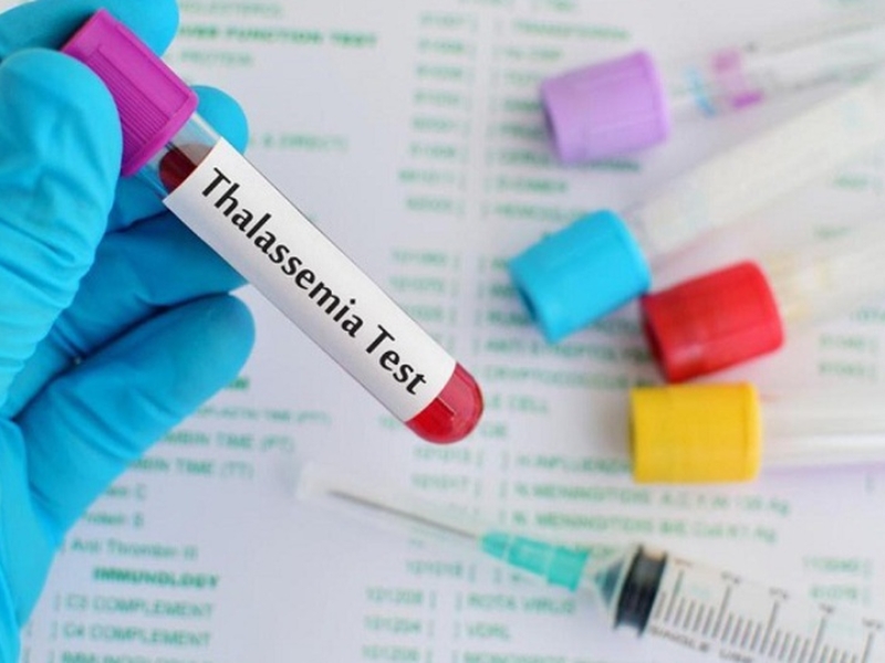 Xét nghiệm Thalassemia giúp xác định tình trạng mang gen hoặc mắc bệnh tan máu bẩm sinh