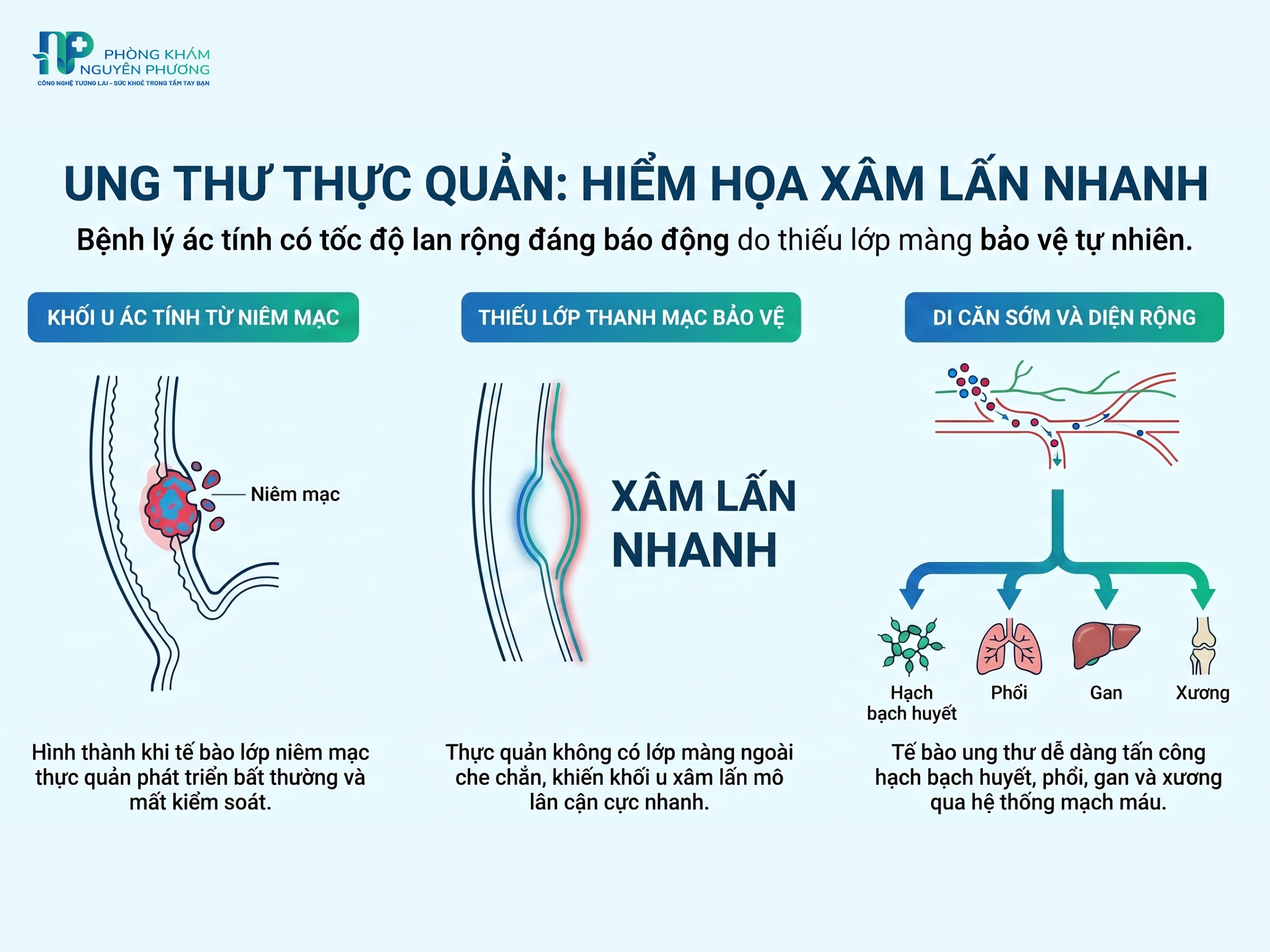 Ung thư thực quản xâm lấn nhanh, dễ di căn đến nhiều cơ quan