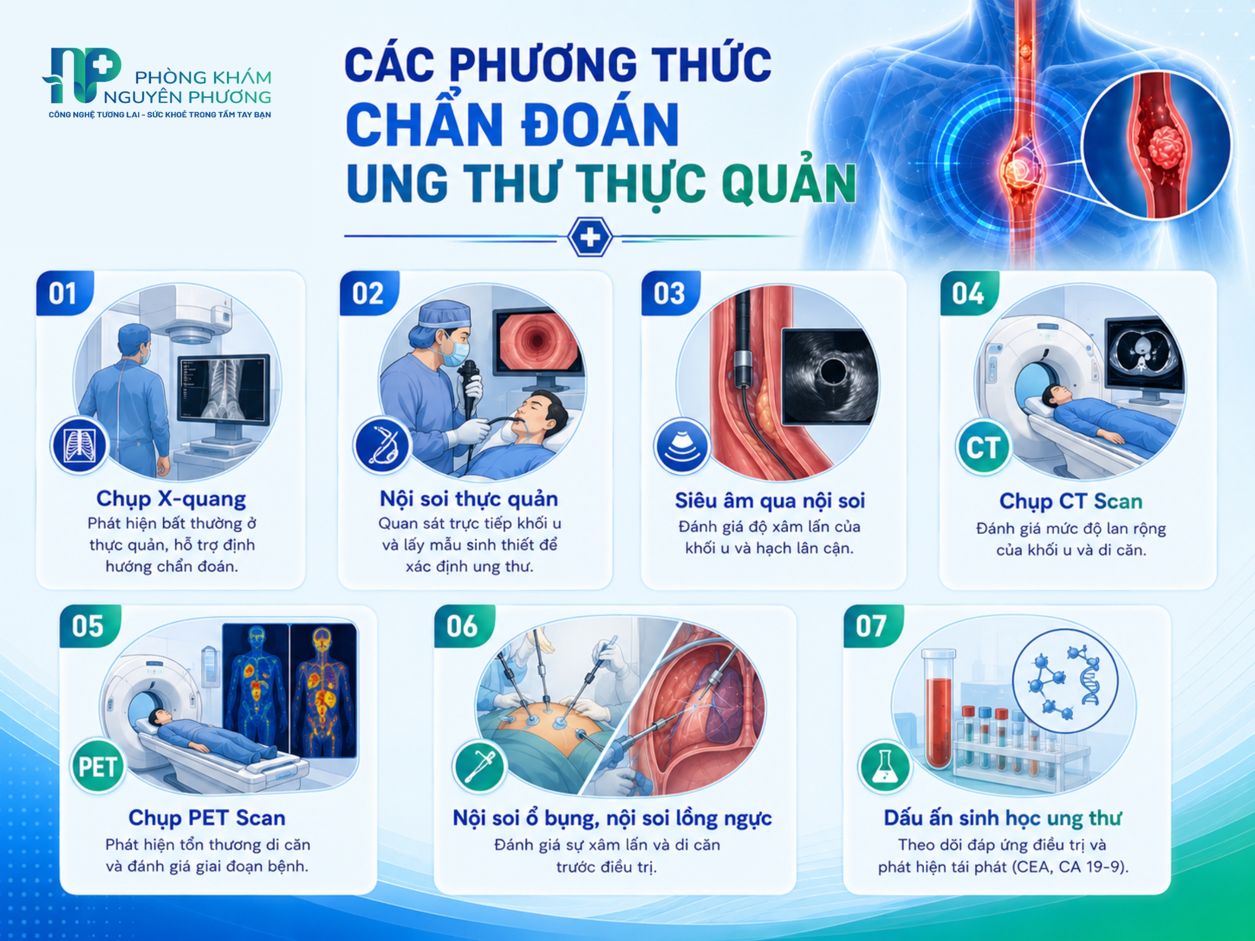 Các cách chẩn đoán giúp phát hiện chính xác ung thư thực quản