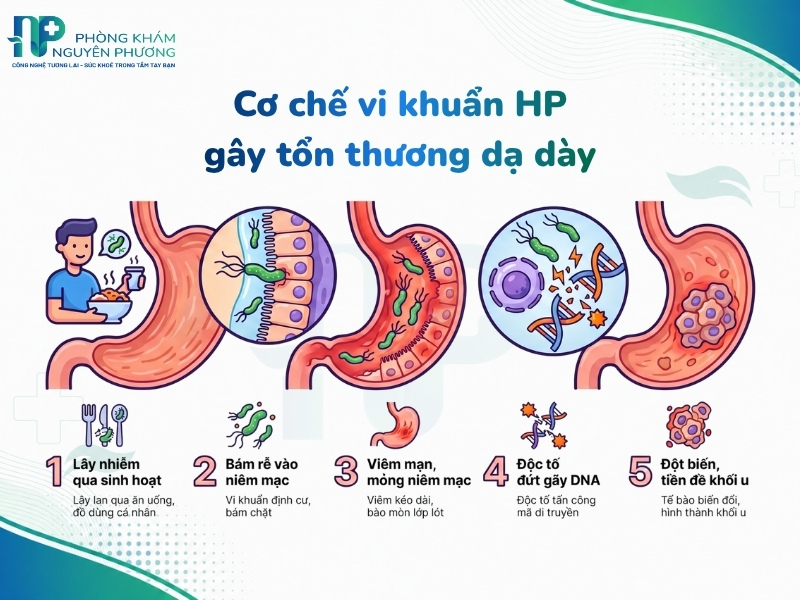 Mối liên hệ giữa vi khuẩn lây nhiễm và nguy cơ ung thư