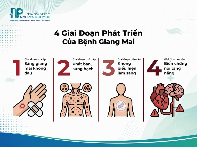 Sơ đồ minh họa 4 giai đoạn phát triển thầm lặng của bệnh giang mai