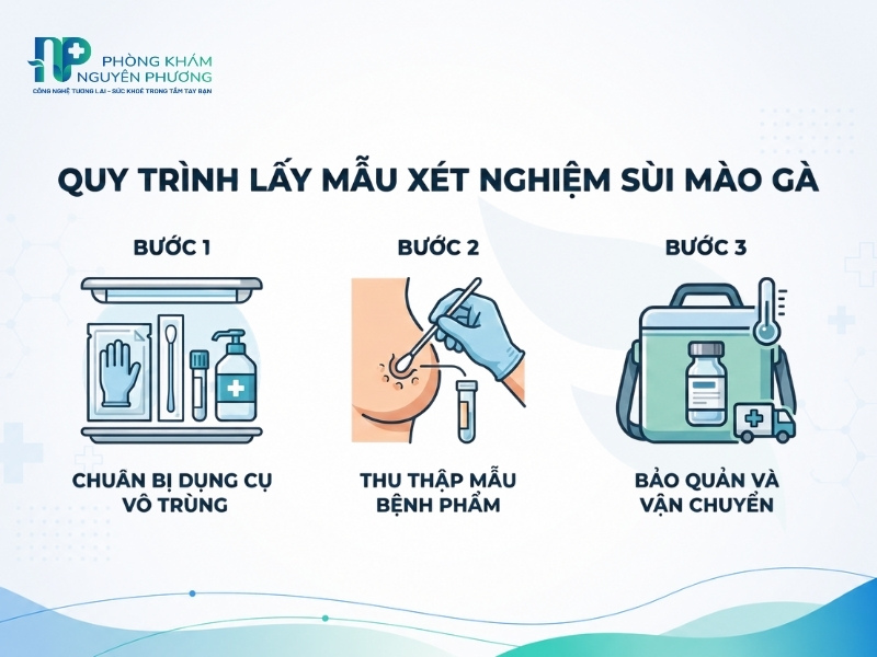 Quy trình 3 bước lấy mẫu xét nghiệm sùi mào gà chuẩn y khoa