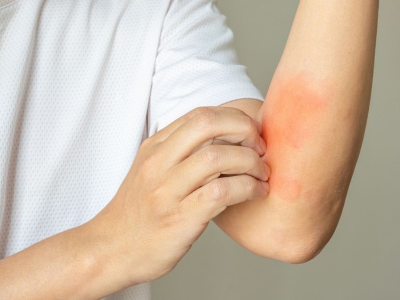 Truyền nước biển có thể gây dị ứng hoặc đau tại chỗ truyền