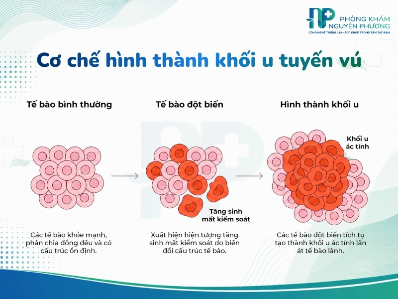 Sự phát triển mất kiểm soát của tế bào lỗi tích tụ thành khối u ác tính.