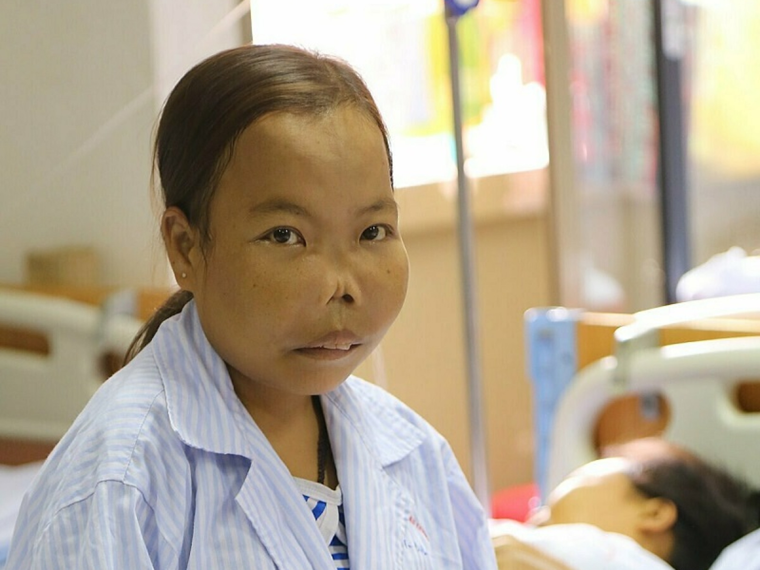 Thalassemia thể nặng có thể gây nhiều biến chứng và ảnh hưởng nghiêm trọng đến tuổi thọ