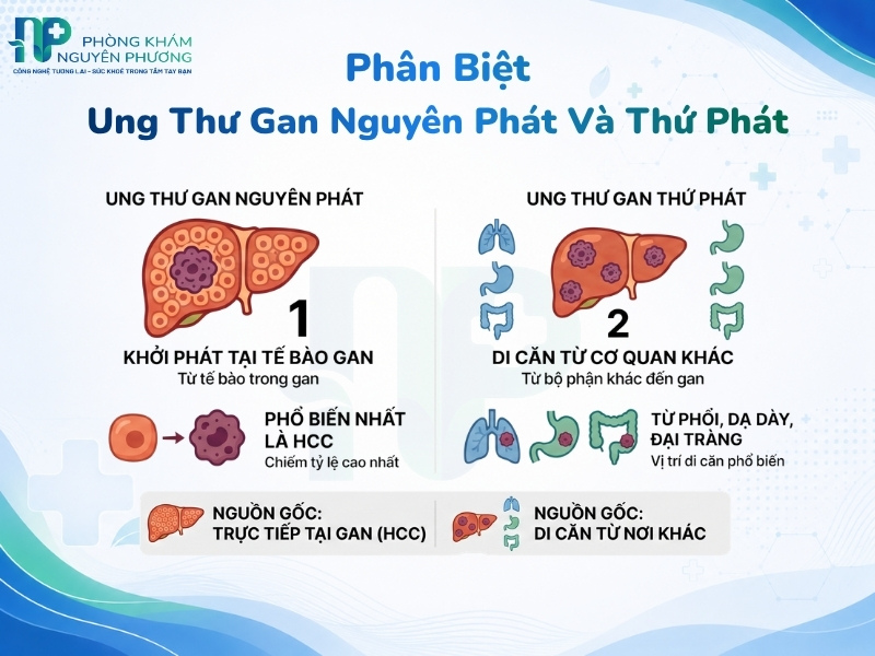 Phân biệt bản chất ung thư gan nguyên phát và di căn từ cơ quan khác